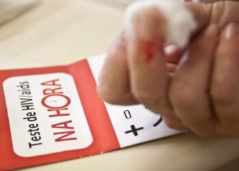 uma-pessoa-morre-por-minuto-no-mundo-por-causas-relacionadas-a-aids